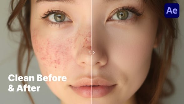 Minimalistic & Clean Before & After Comparison – After Effects Template